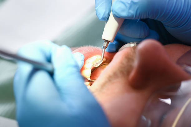 Best Urgent Care for Lost Fillings or Crowns in Crockett, TX