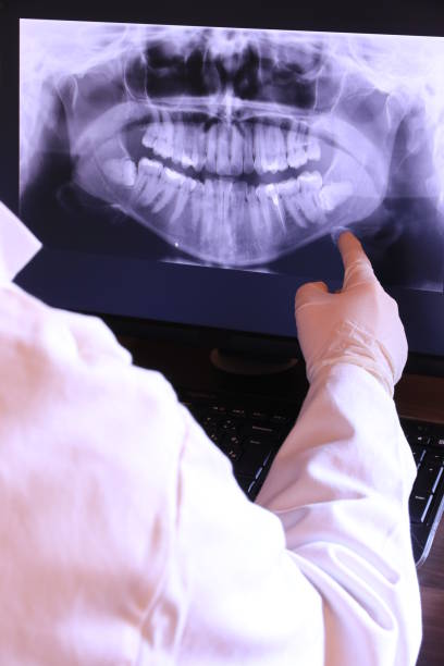 Best Emergency Tooth Extraction in Crockett, TX