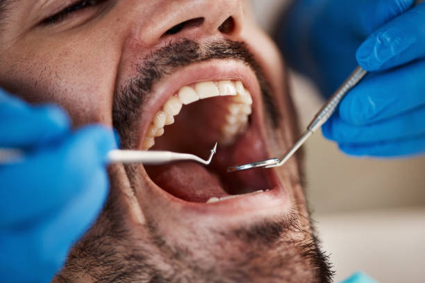 Best Emergency Denture Repair in Crockett, TX